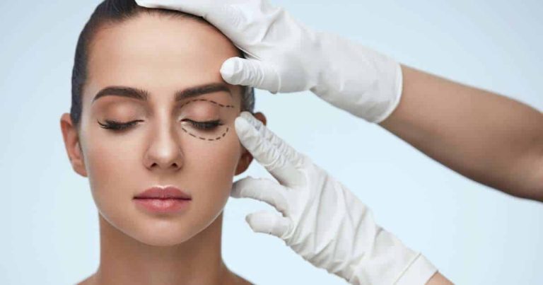Finishing min Blépharoplastie