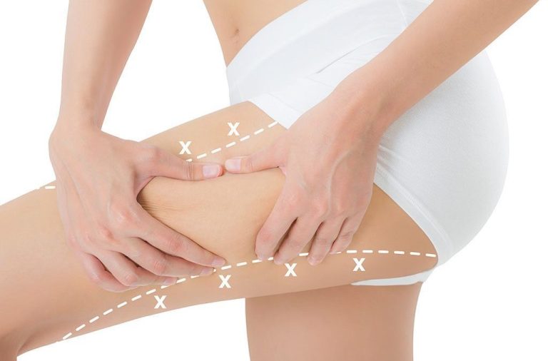 Shaping Finishing min 6 Thigh Lift