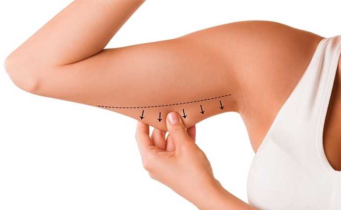 Shaping Finishing min Lifting des bras