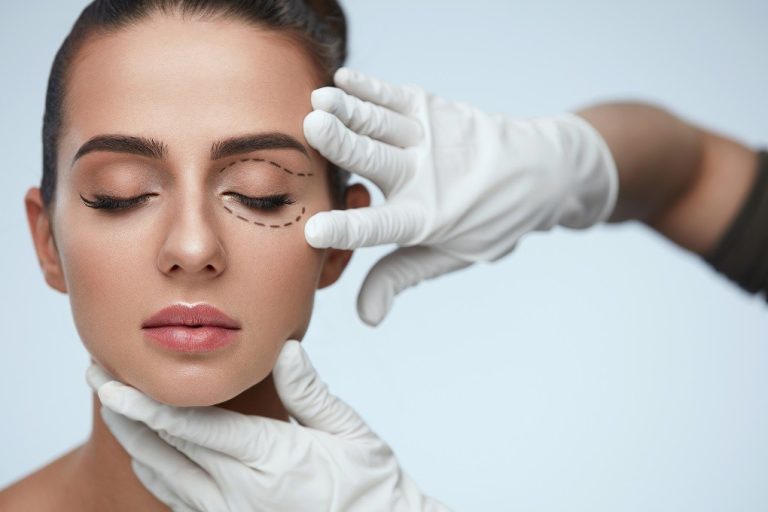 Surgical planning min 3 Face & Neck Lift