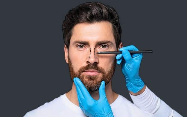 Surgical planning min 5 Rhinoplasty