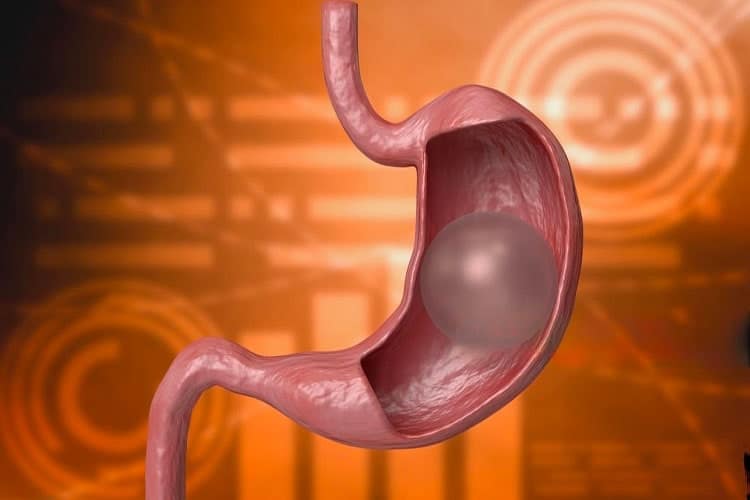 inflation min Capsule Gastrique Elipse