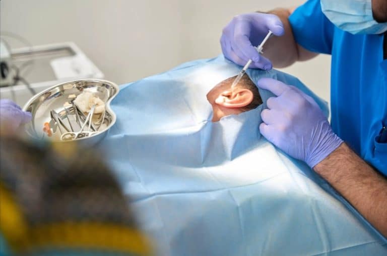 procedure min Otoplastie