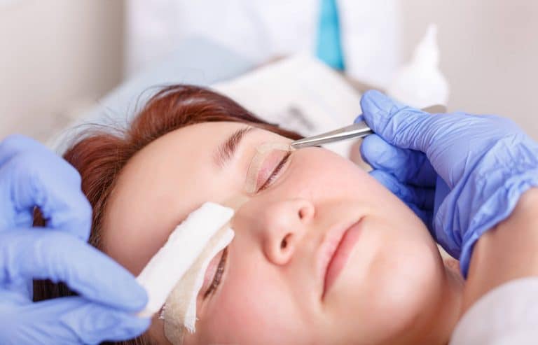 recovery min 2 Blépharoplastie