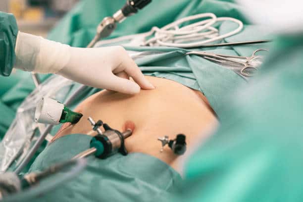 surgical procedure min Bypass Gastrique