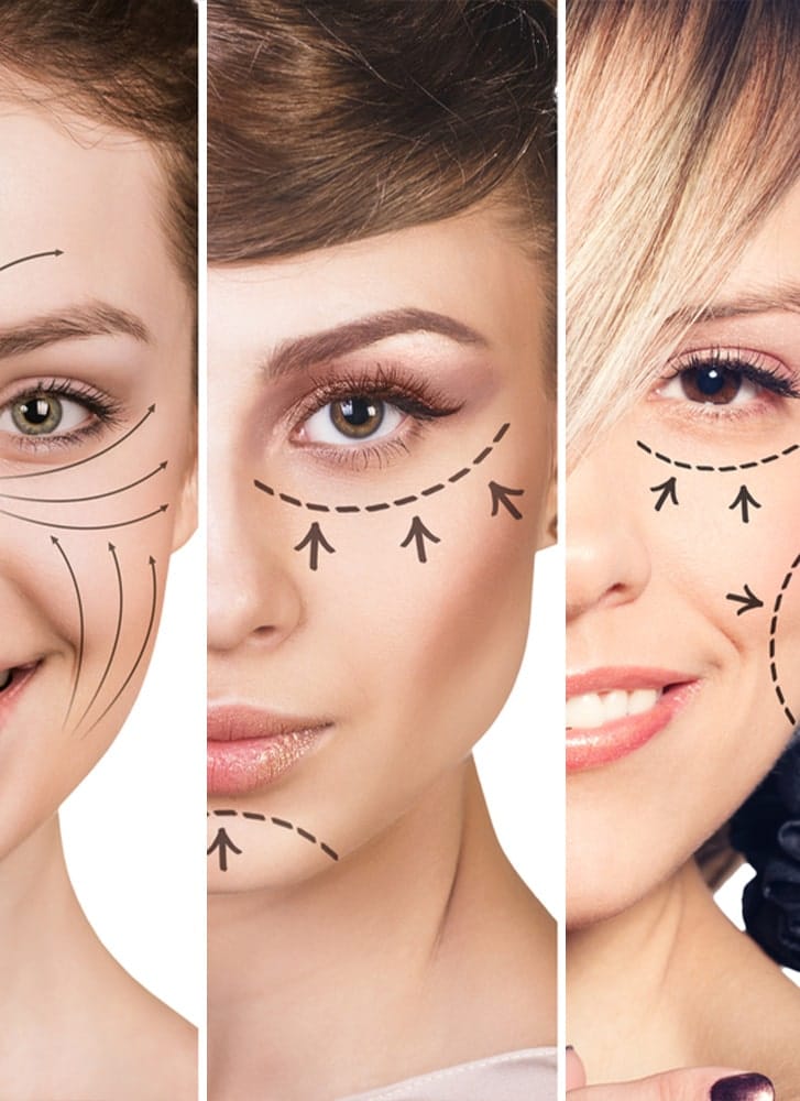 https://essencaclinic.com/wp-content/uploads/2024/12/Face-Lift-Surgery-min.jpg