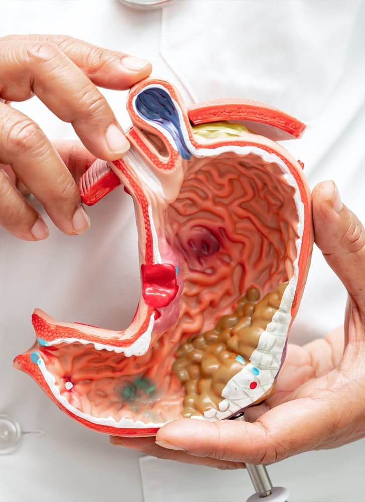 https://essencaclinic.com/wp-content/uploads/2024/12/Gastric-Bypass-min.jpg