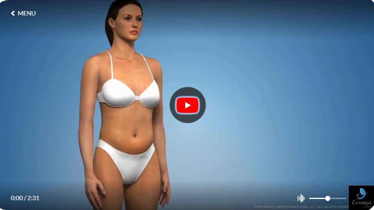 https://essencaclinic.com/wp-content/uploads/2024/12/Genital-Aesthetics-youtube.jpg
