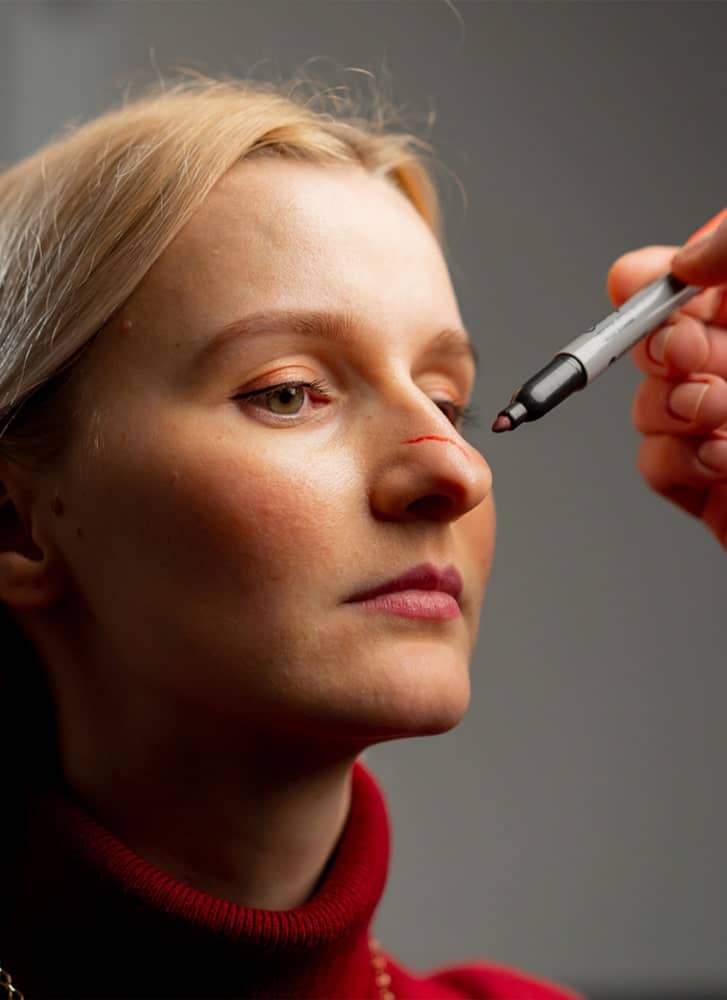 https://essencaclinic.com/wp-content/uploads/2024/12/Rhinoplasty1-min.jpg
