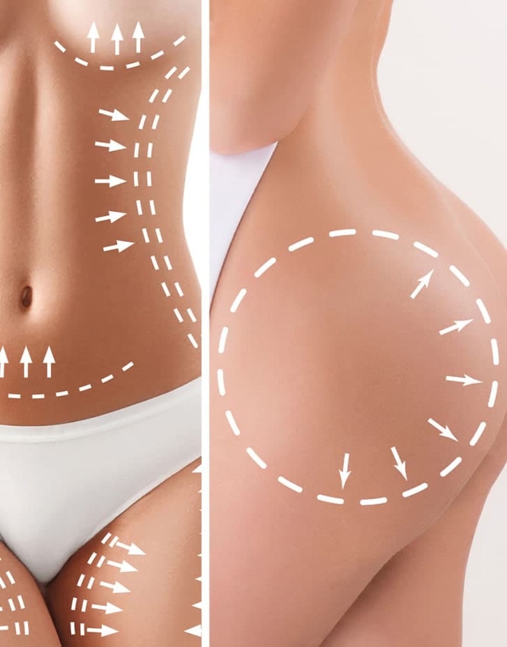https://essencaclinic.com/wp-content/uploads/2024/12/What-is-Body-Shaping-BBL-min.jpg