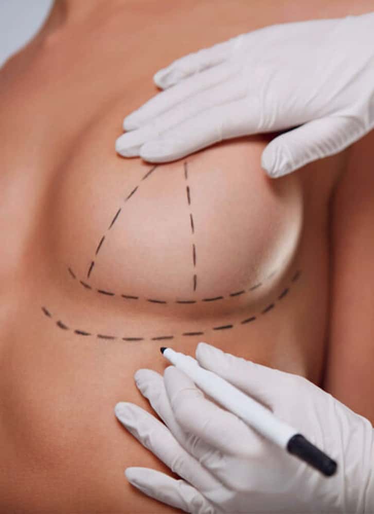 https://essencaclinic.com/wp-content/uploads/2024/12/what-is-arm-lift-min-min-1.jpg