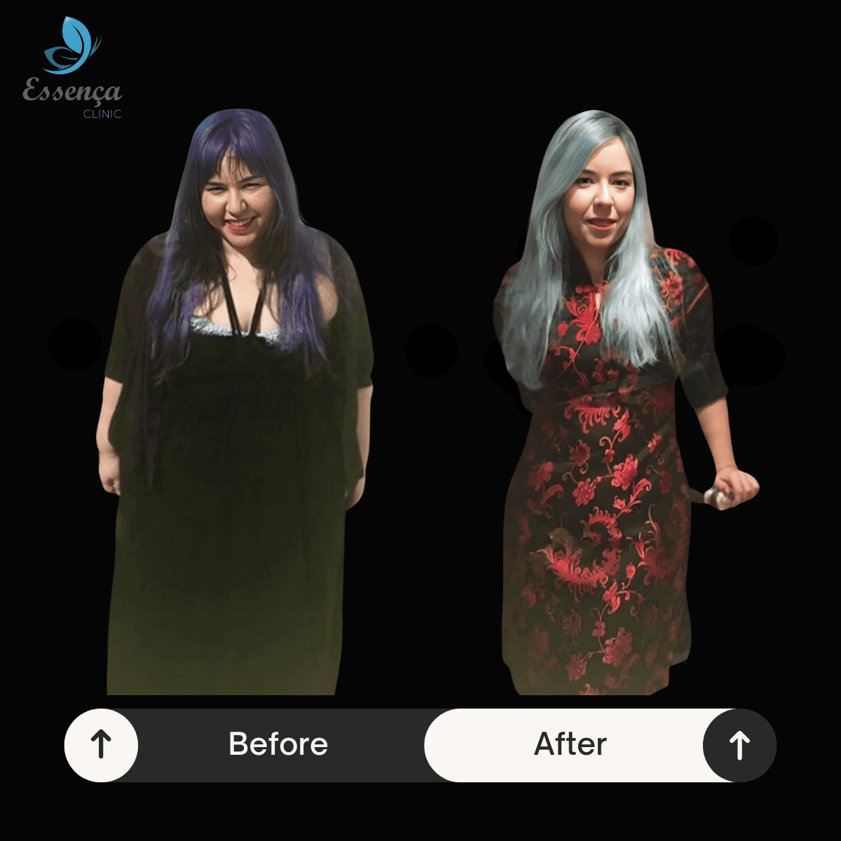 Before After Bariatric Surgery (1)