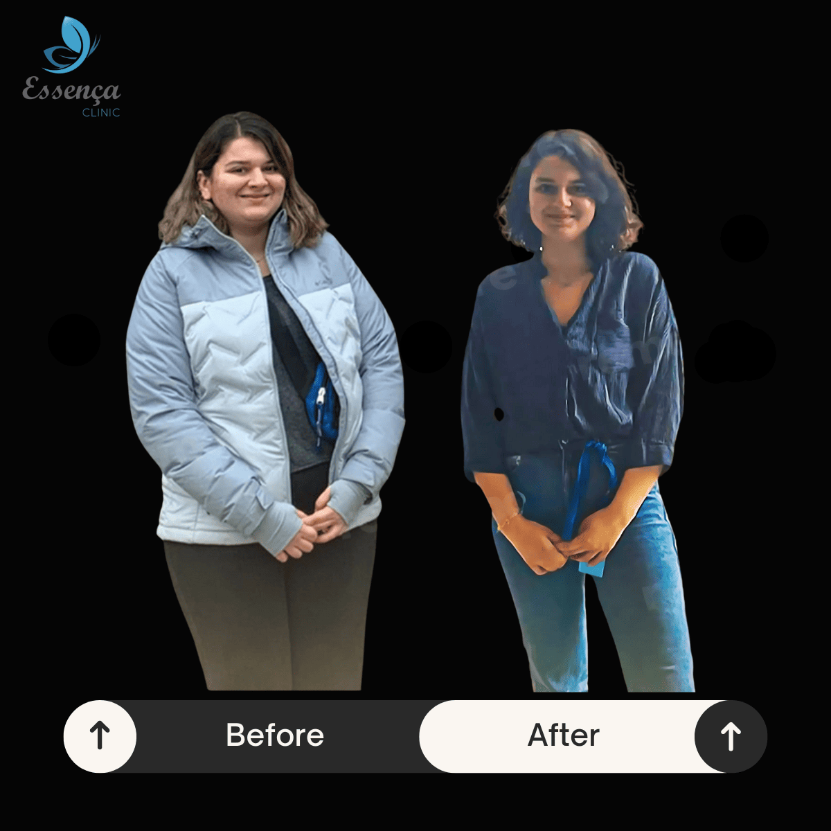 Before After Bariatric Surgery (2)