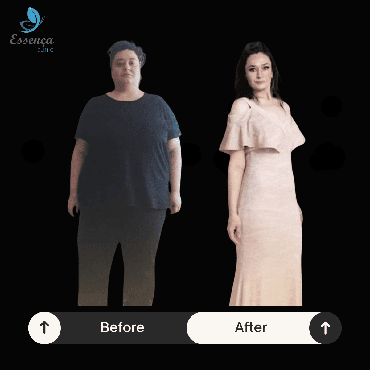 Before After Bariatric Surgery (4)