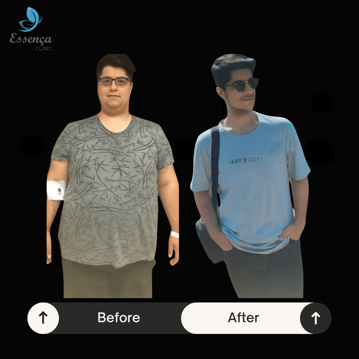 Before After Bariatric Surgery (6)
