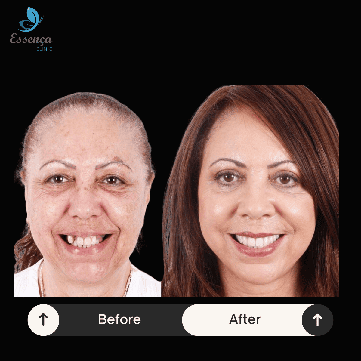 Before After Dental Treatments (10)