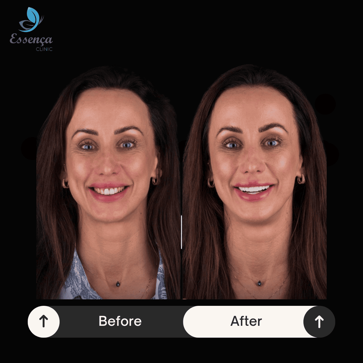 Before After Dental Treatments (11)