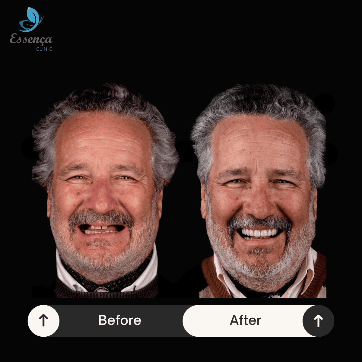 Before After Dental Treatments (14)