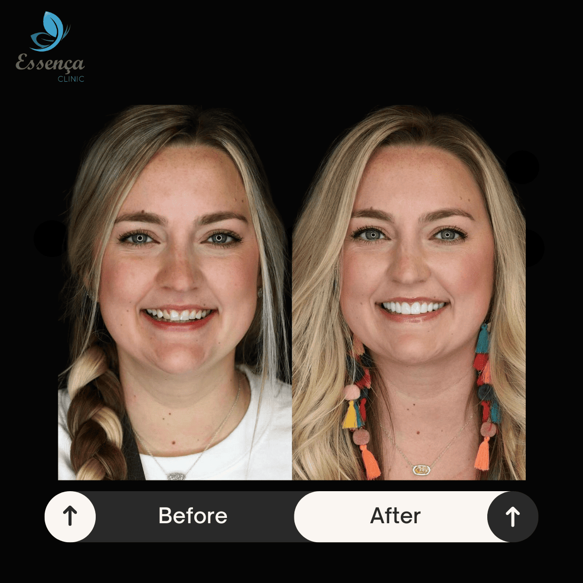 Before After Dental Treatments (15)