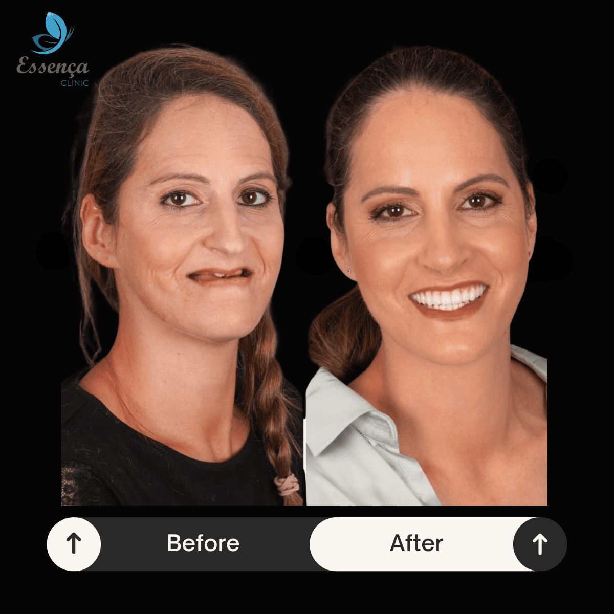 Before After Dental Treatments (16)