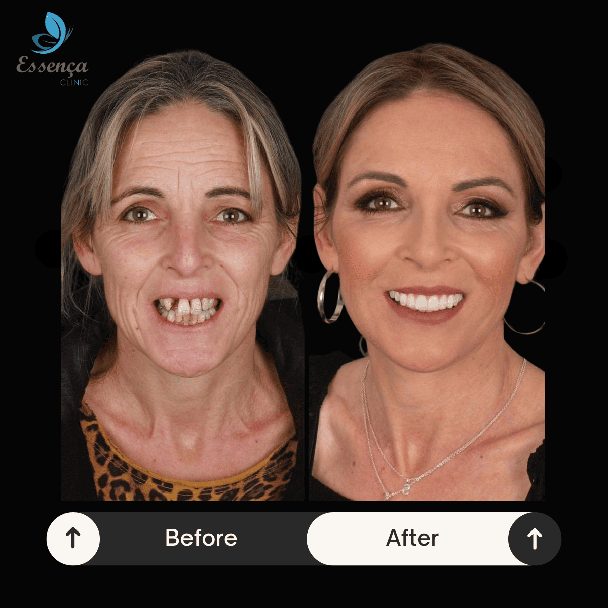 Before After Dental Treatments (17)