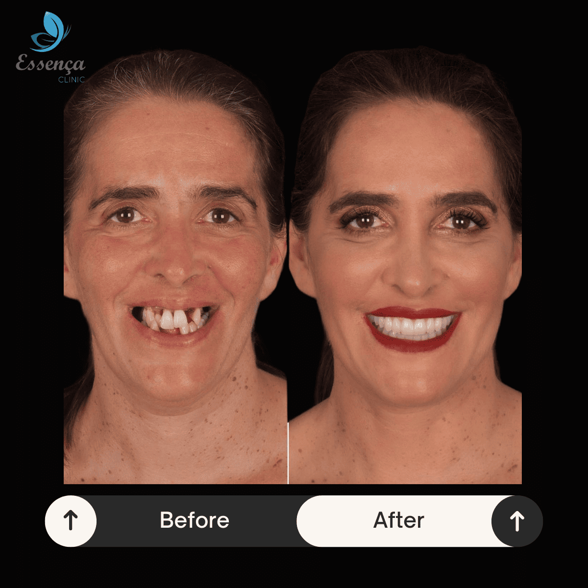 Before After Dental Treatments (18)