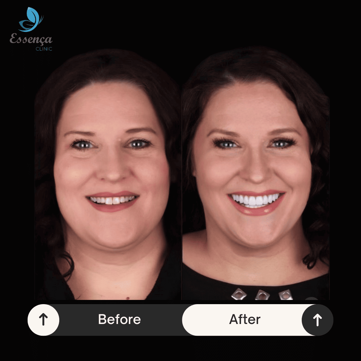 Before After Dental Treatments (2)