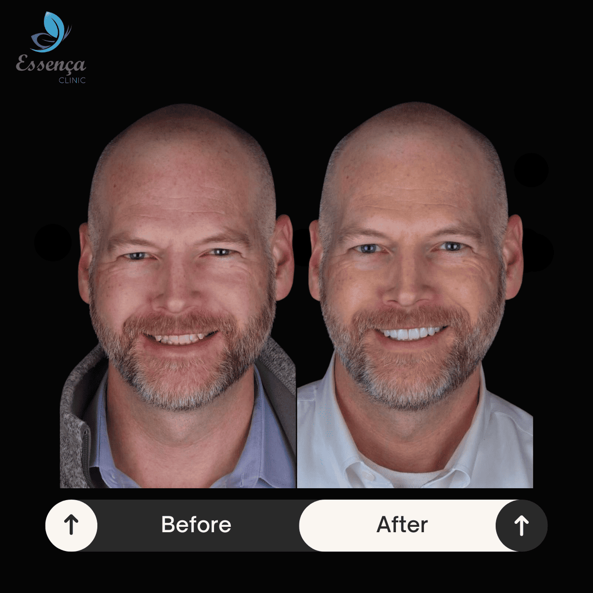 Before After Dental Treatments (20)