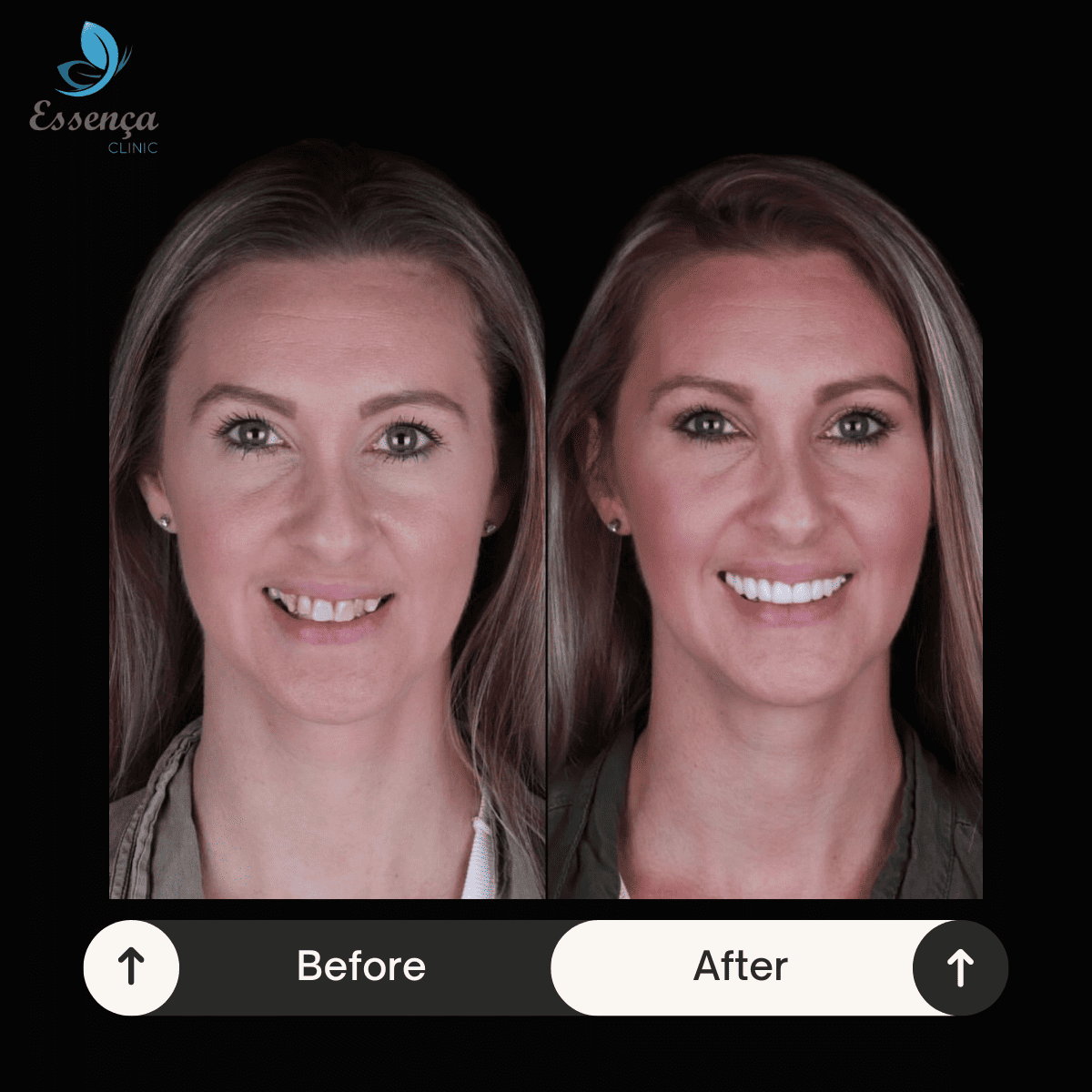 Before After Dental Treatments (21)