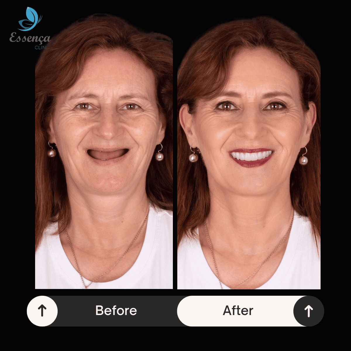 Before After Dental Treatments (22)
