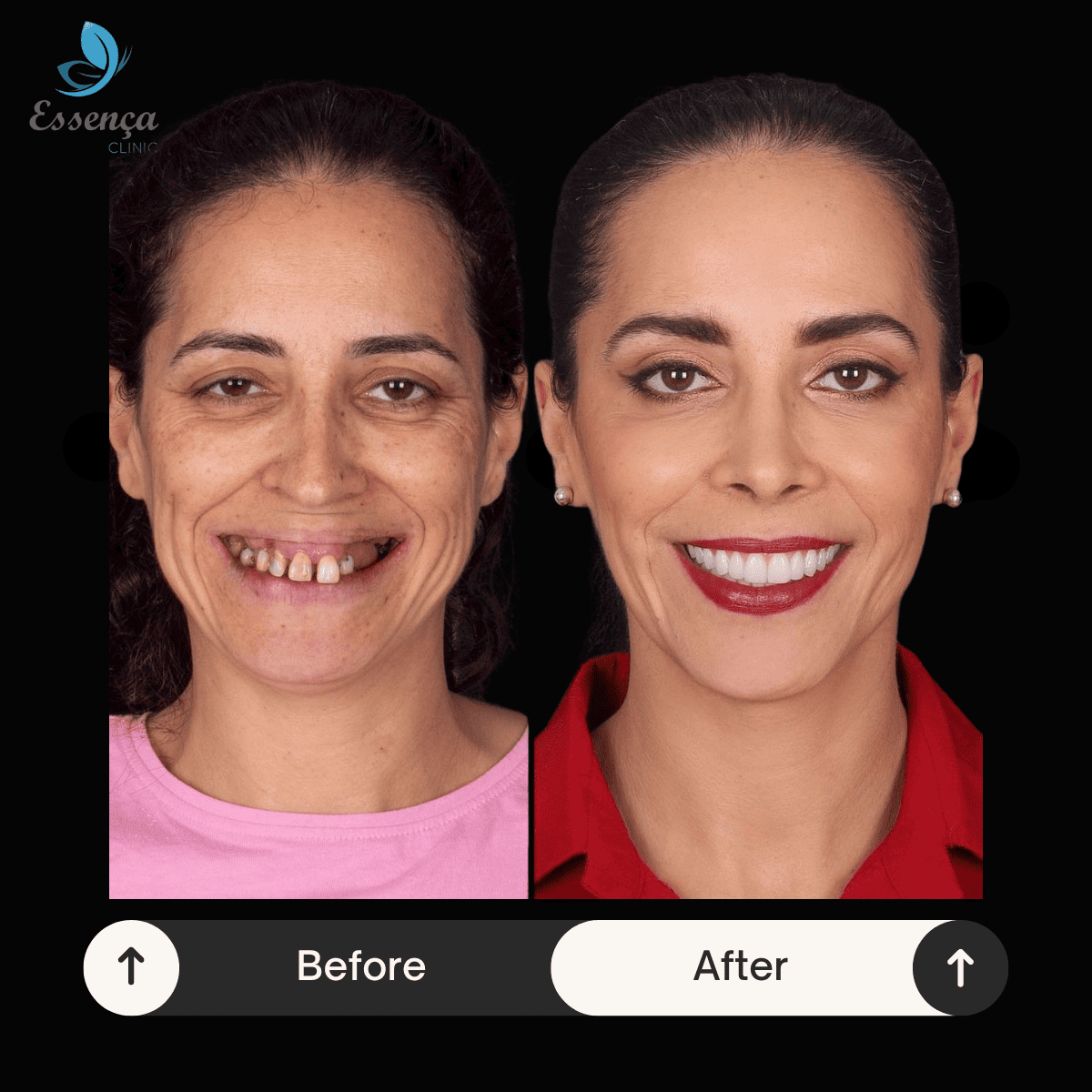 Before After Dental Treatments (23)