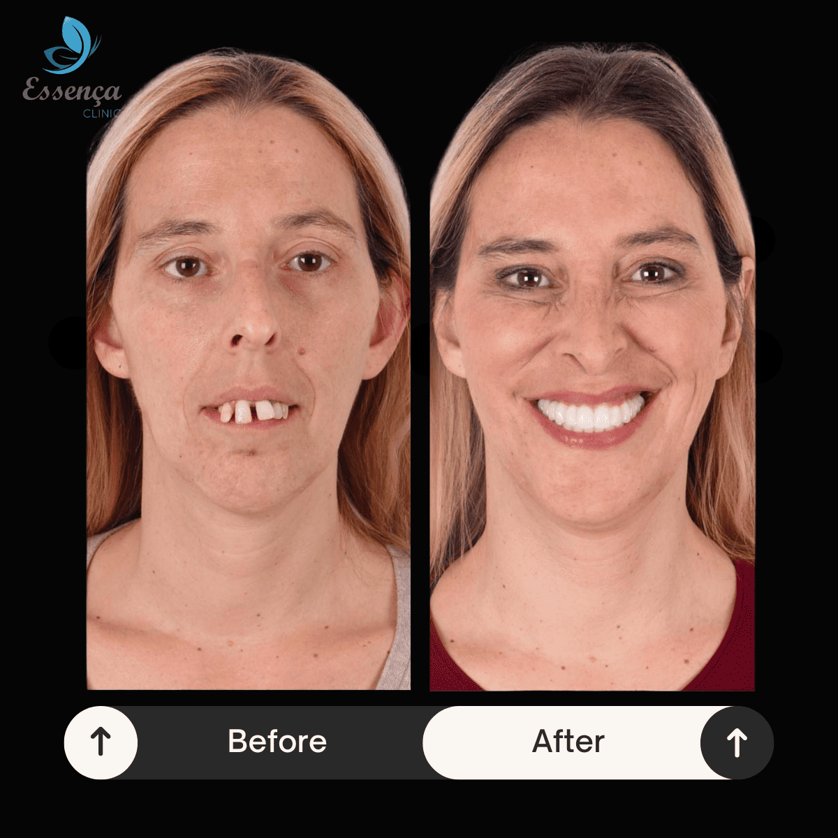 Before After Dental Treatments (25)