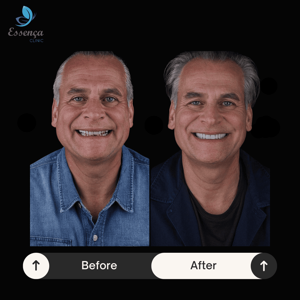 Before After Dental Treatments (27)