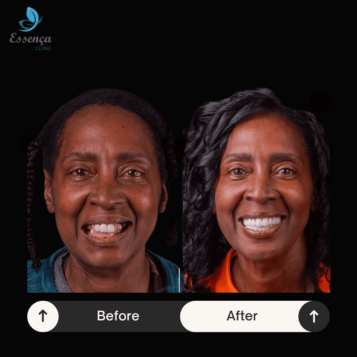 Before After Dental Treatments (29)