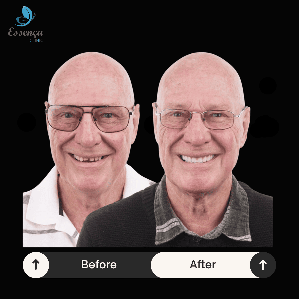 Before After Dental Treatments (3)