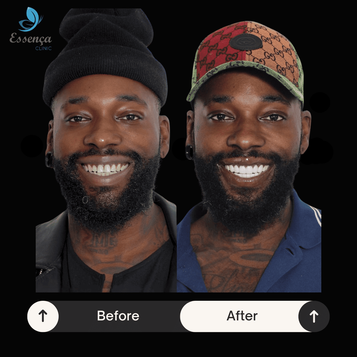 Before After Dental Treatments (30)