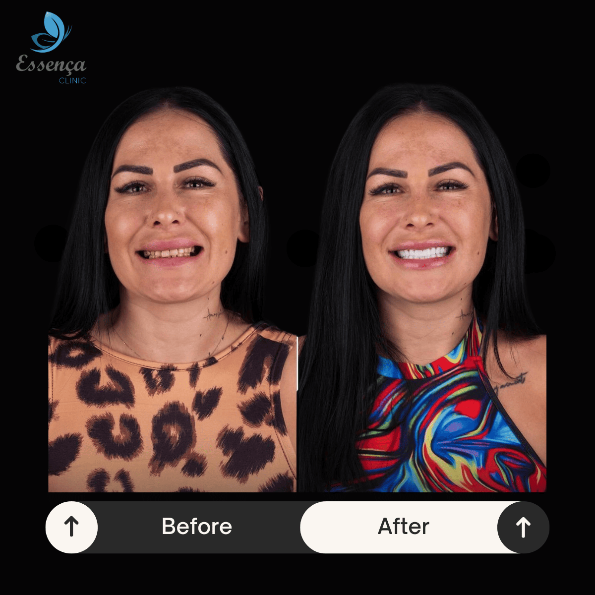 Before After Dental Treatments (4)