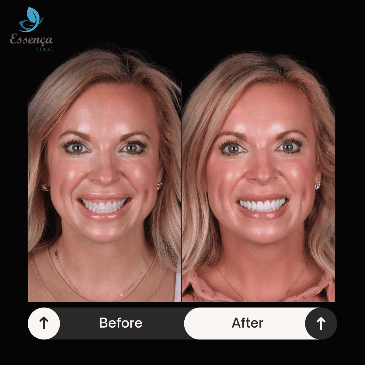 Before After Dental Treatments (5)