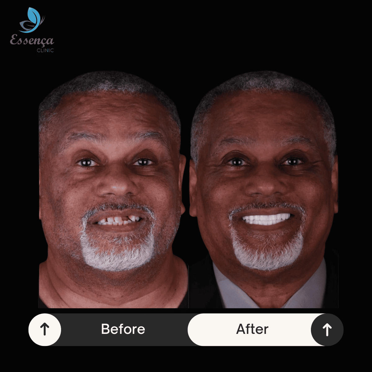 Before After Dental Treatments (7)