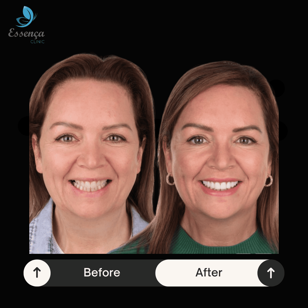 Before After Dental Treatments (9)