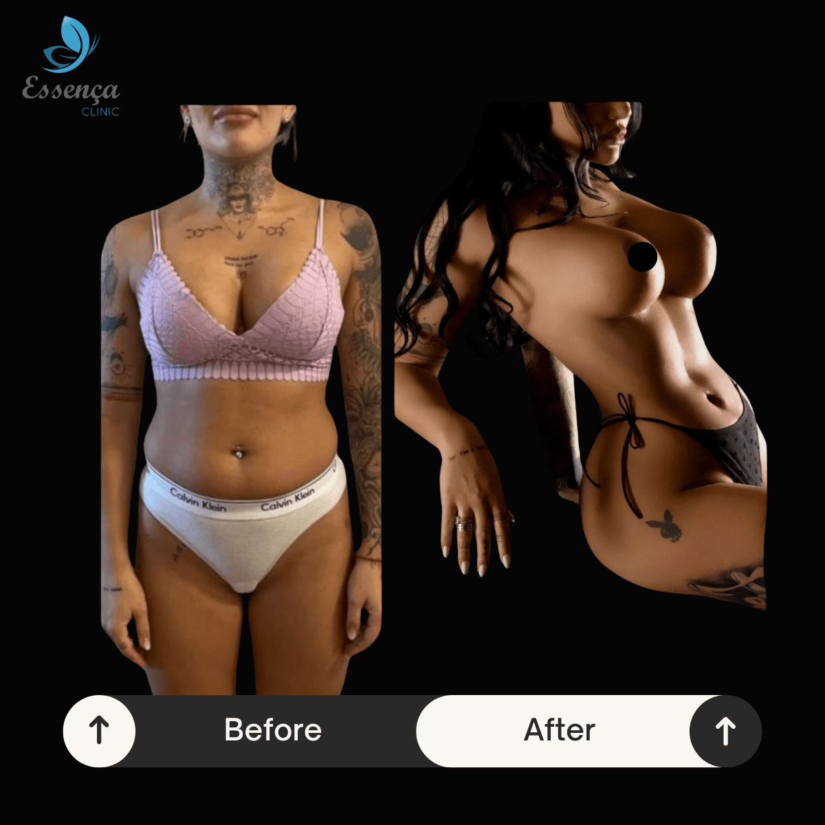 Before After Dr. Burak Efeoğlu (53)-min