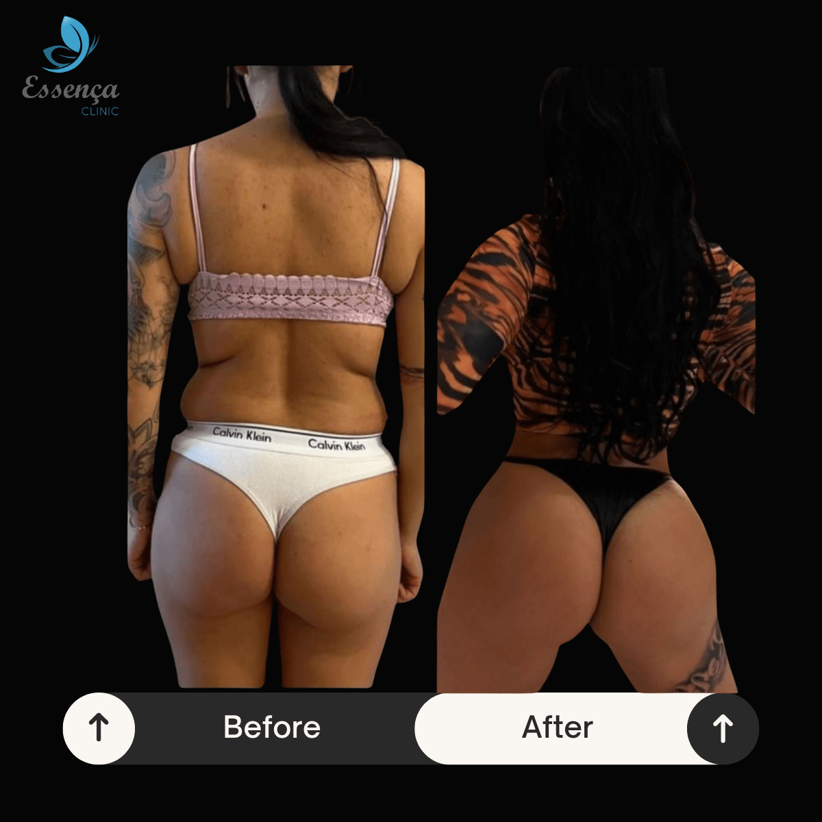 Before After Dr. Burak Efeoğlu (54)-min