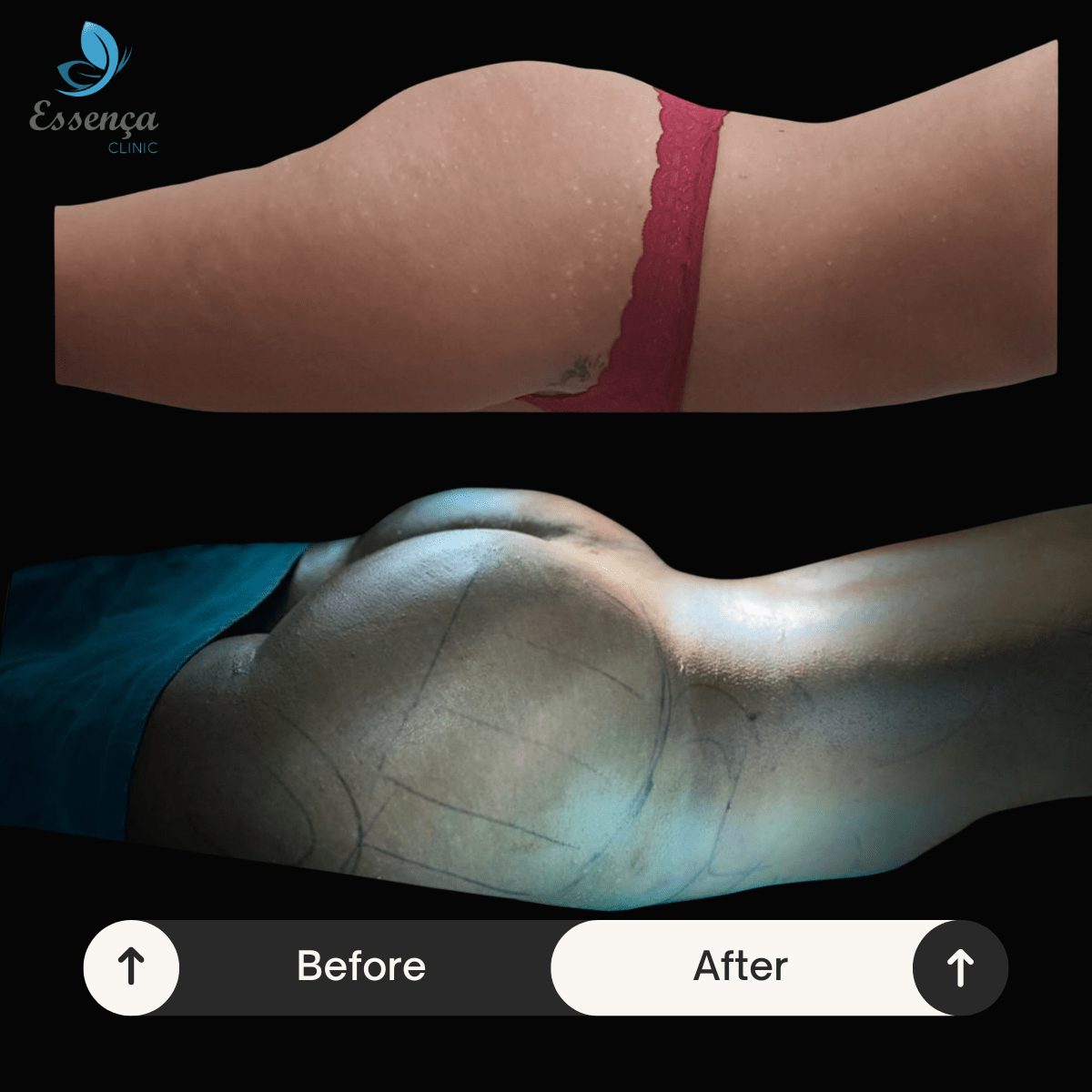 Before After Dr. Burak Efeoğlu (63)-min