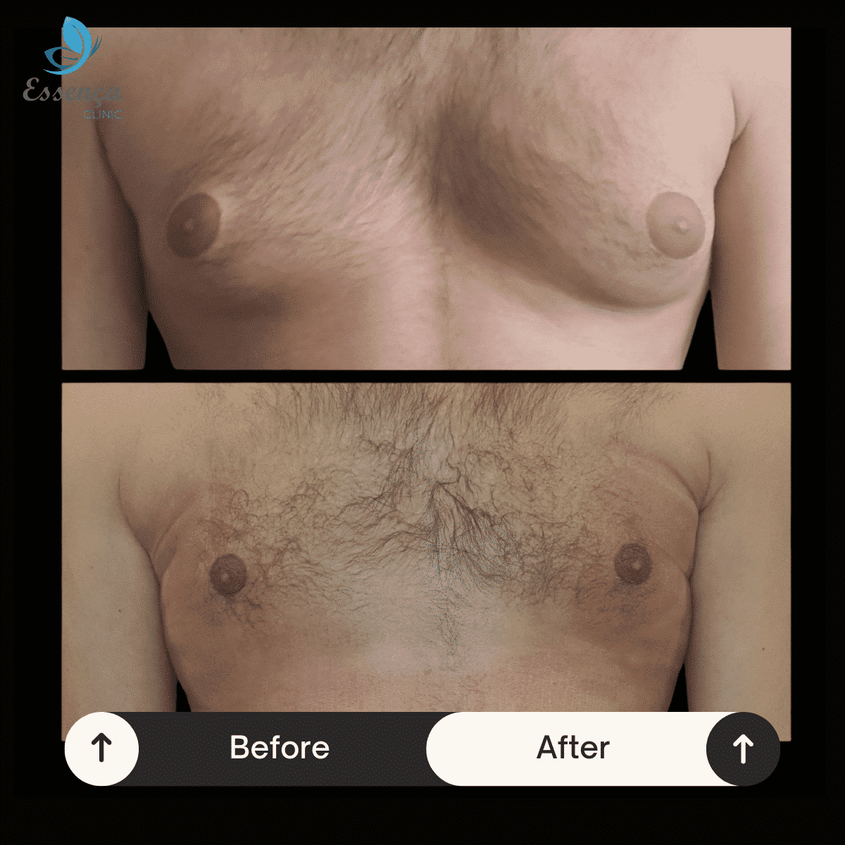 Before After Dr. Burak Efeoğlu (67)-min