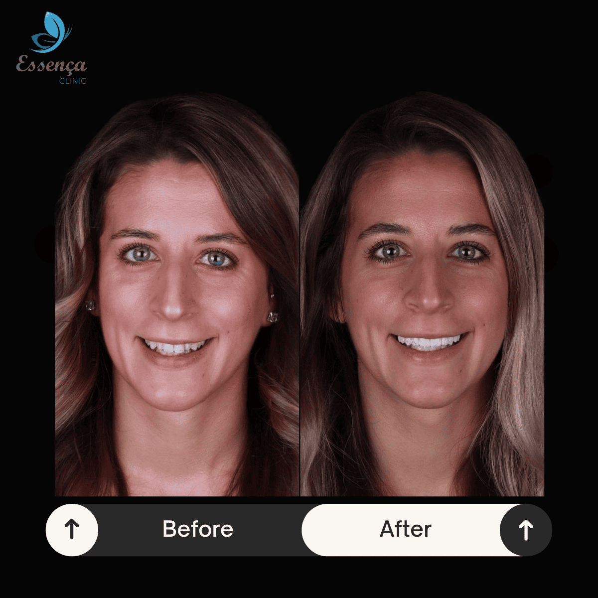 Before After Dr. Remziye Kuşağlı (1)