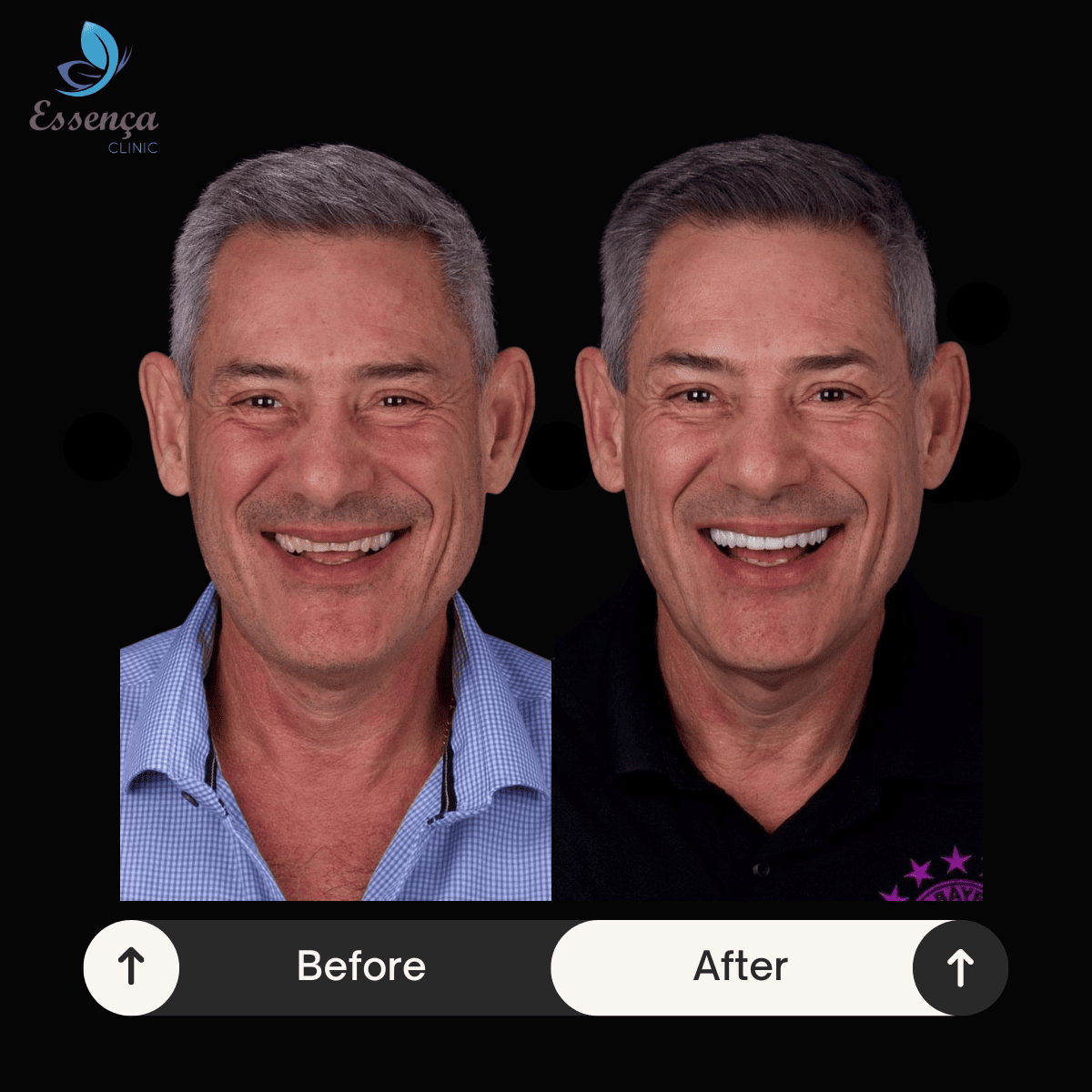 Before After Dr. Remziye Kuşağlı (13)