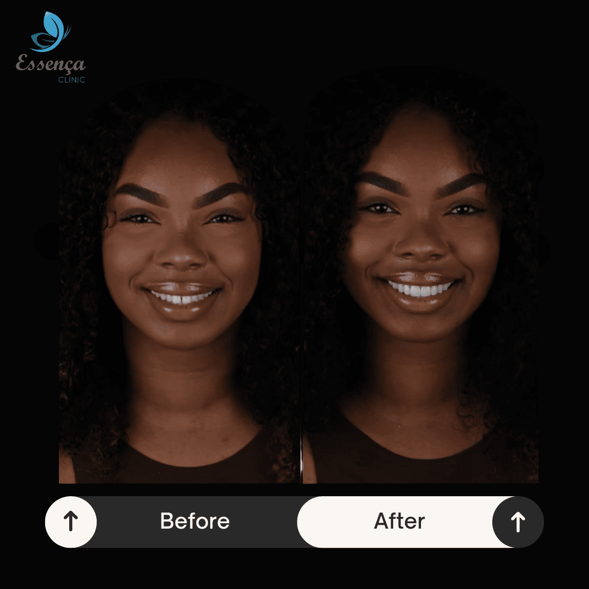 Before After Dr. Remziye Kuşağlı (28)