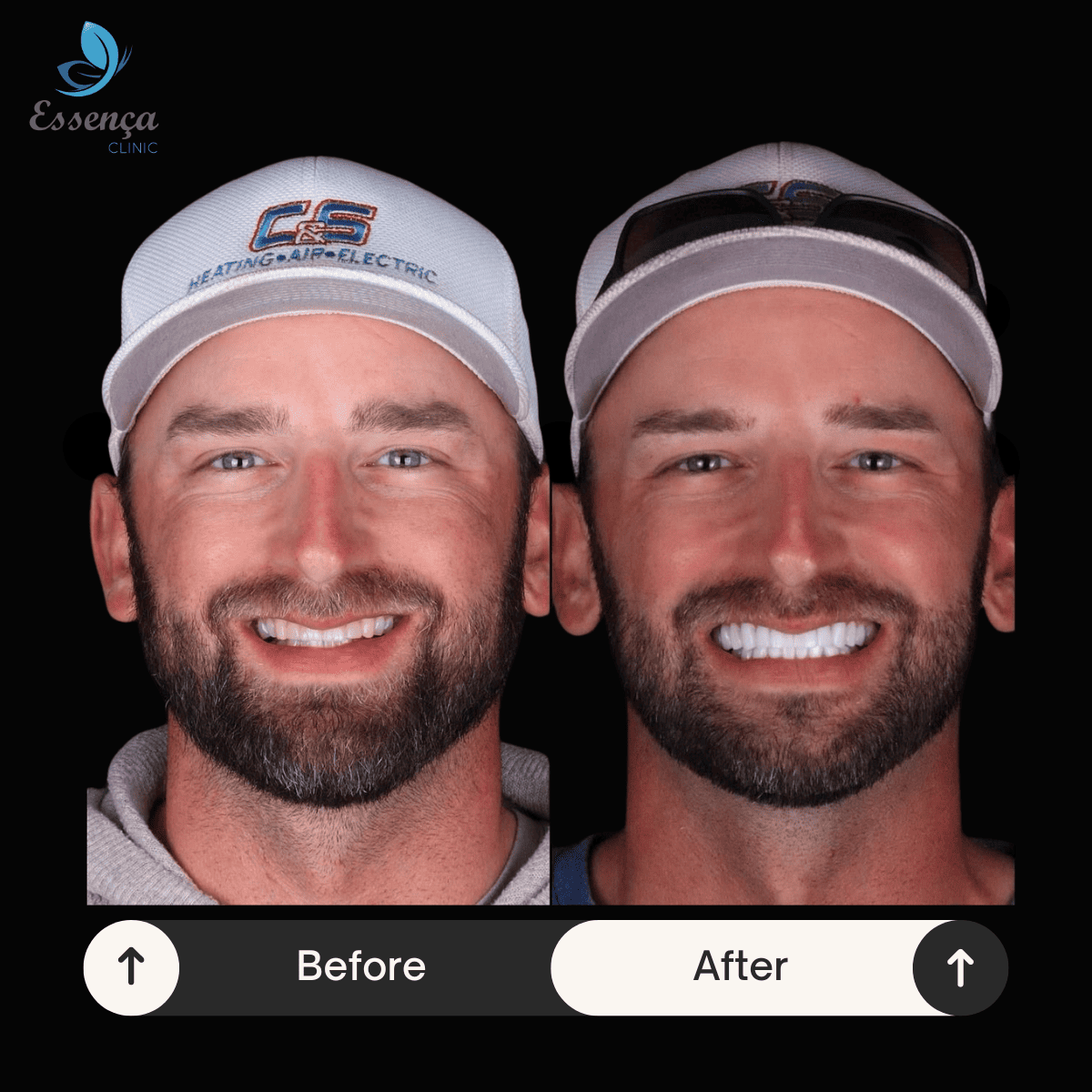 Before After Dr. Remziye Kuşağlı (6)