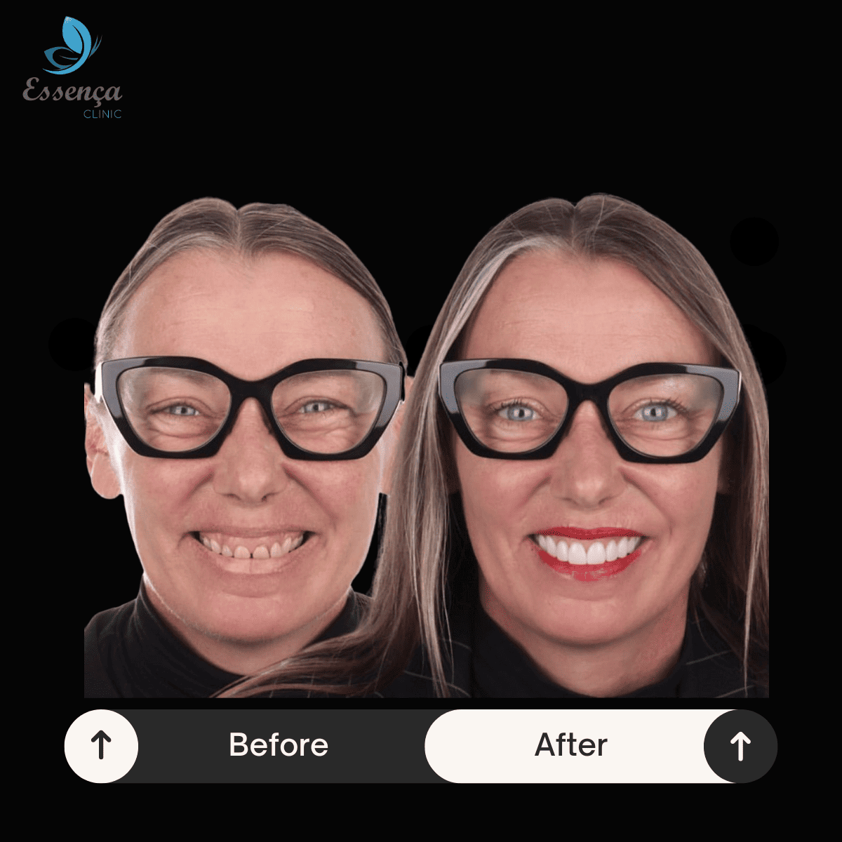 Before After Dr. Remziye Kuşağlı (8)