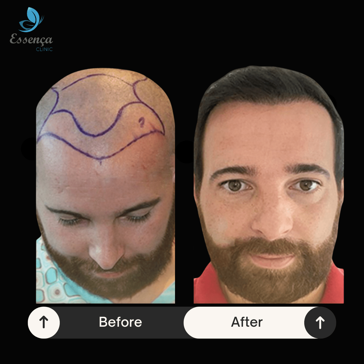 Before After Dr. Sema Kızıldağ (1)-min